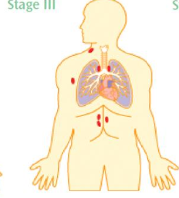 <p>multiple sites on both sides of the diaphragm</p>
