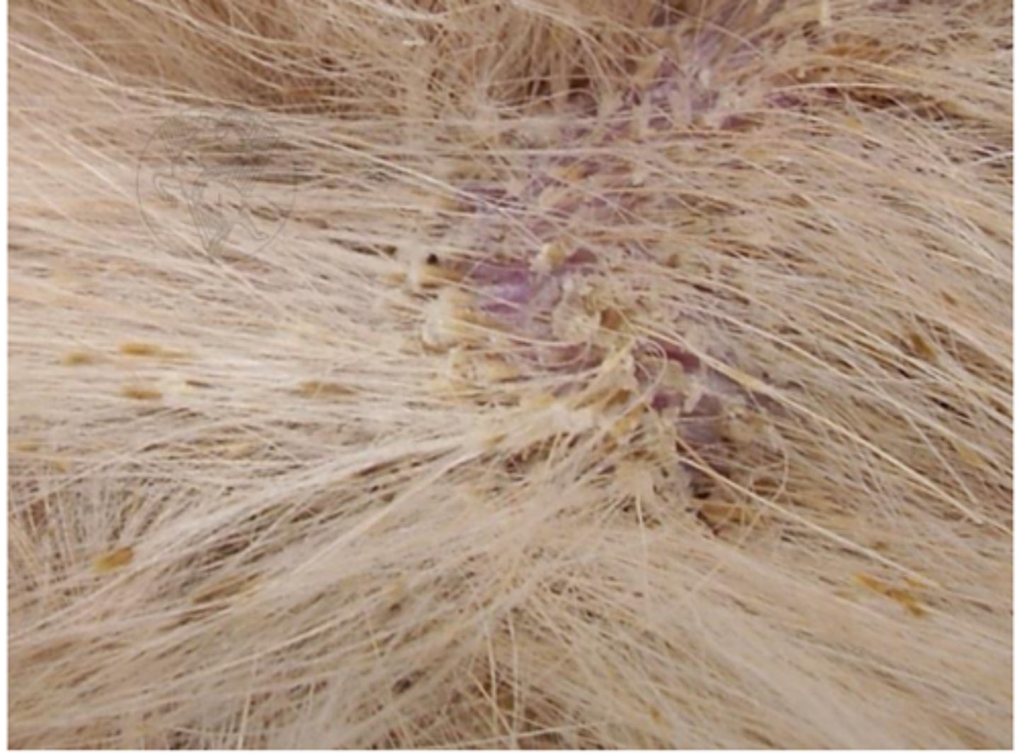 <p>what is this condition called? what yeast species causes it? what sample would we take?</p>