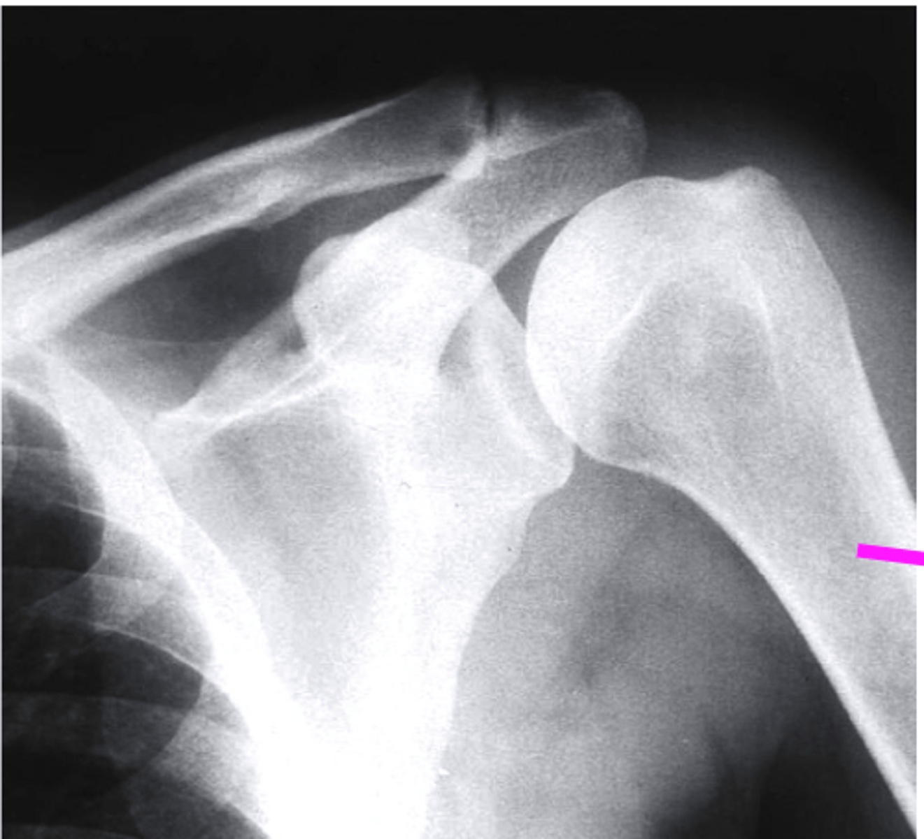 <p>what does the pink line point to?</p>