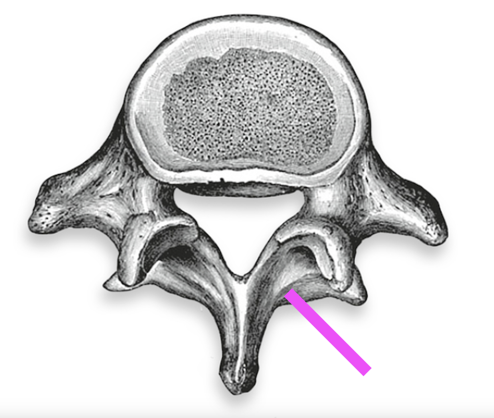 <p>What part of the vertebrae is this?</p>