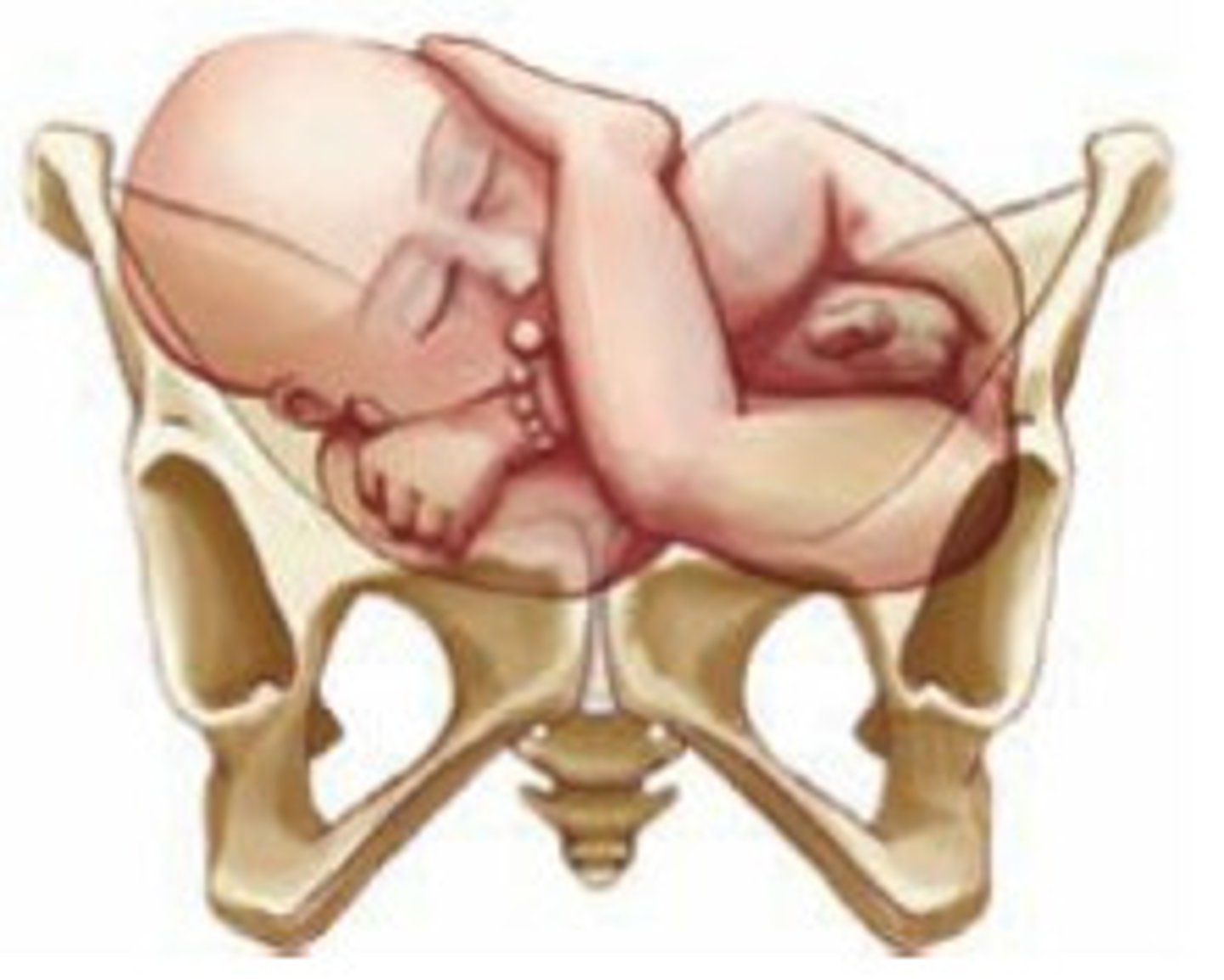 <p>baby is in transverse position at delivery, must be turned</p>