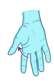 reposition it/ back to anatomical position
