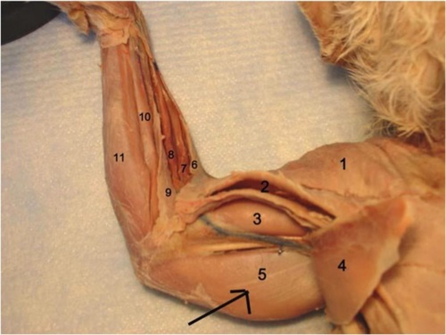<p>What muscle is number 4 (ignore arrow)?</p><p>Origin?</p><p>Insertion?</p><p>Action?</p><p>Nerve?</p>