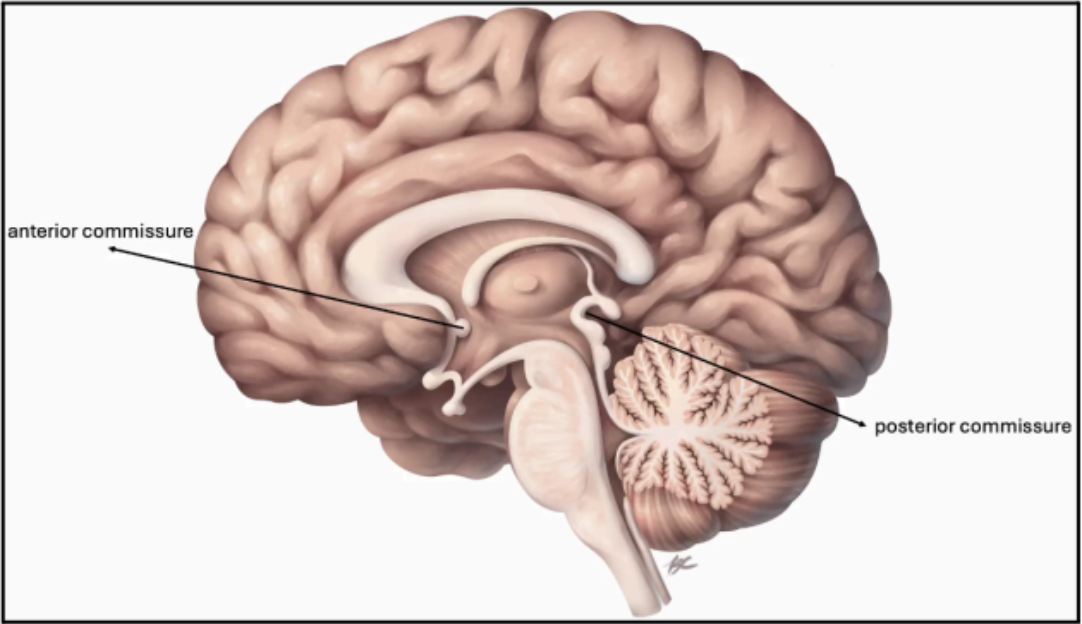 <p>Posterior Commissure</p>