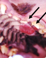 <p>histo - low</p><p>biologically - high</p><p>*difficult to differentiate from a fibroma on histopathology</p>