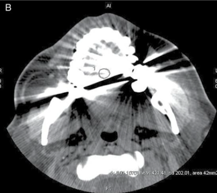 <p>Why is this ROI not appropriate?</p>