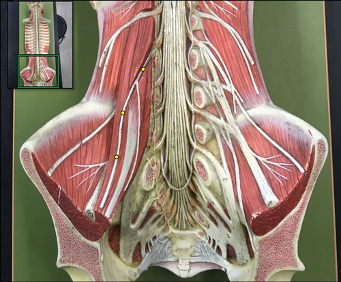 <p>Wishbone of the leg</p>