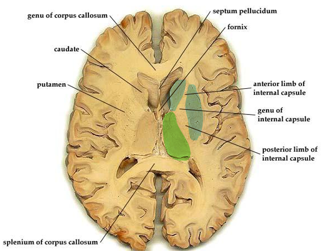 <ul><li><p>middle of brain</p></li><li><p>boomerang shaped</p></li><li><p>positioned btw basal ganglia and thalamus</p></li></ul><p></p>