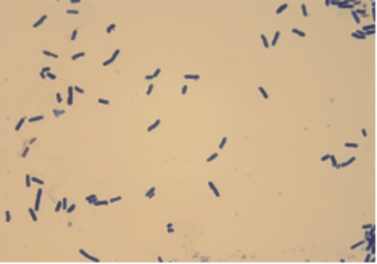 <p>this bacteria is associated with hemorrhagic enterotoxemia</p>