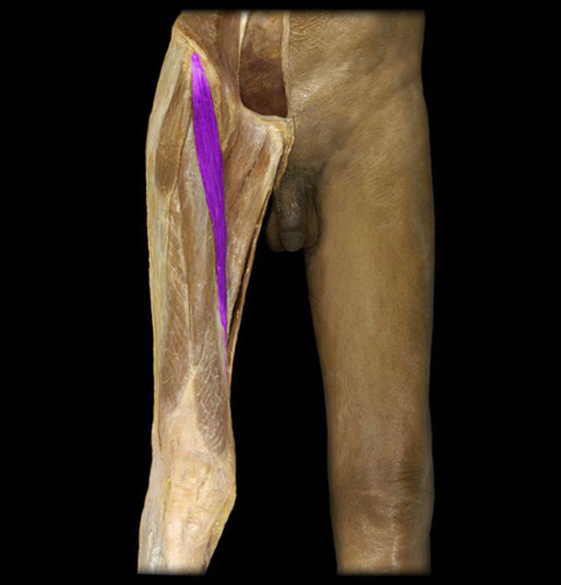 <p>Proximal attachment: Anterior superior iliac spine</p><p>Distal attachment: Tibial tuberosity</p><p>Comments, Applications and Relationships: Secondary action- flexes at the knee. Helpful hint- a long thin muscle crossing the femur, important in assuming a cross leg position or playing hackey sack.</p><p>Action: Flexor of the thigh at the hip</p>