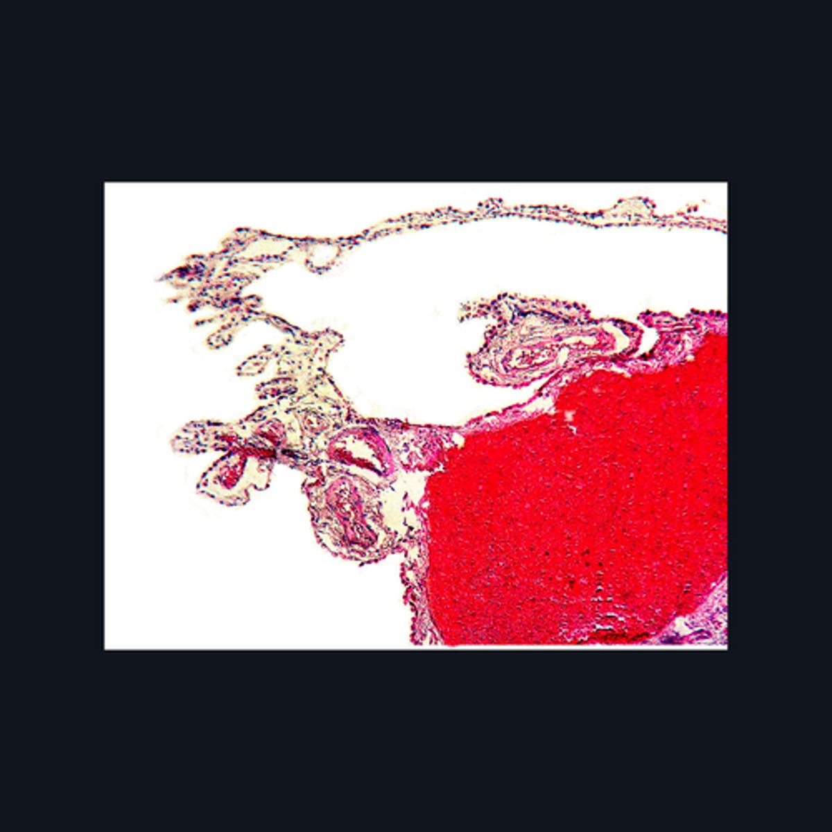 <p>Identify the region of the brain in the given image.</p>