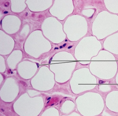 <p><strong>what is the connective tissue?</strong></p>