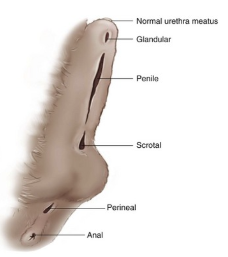<ul><li><p>glandular </p></li><li><p>penile </p></li><li><p>scrotal </p></li><li><p>perineal </p></li><li><p>anal </p></li></ul><p></p>