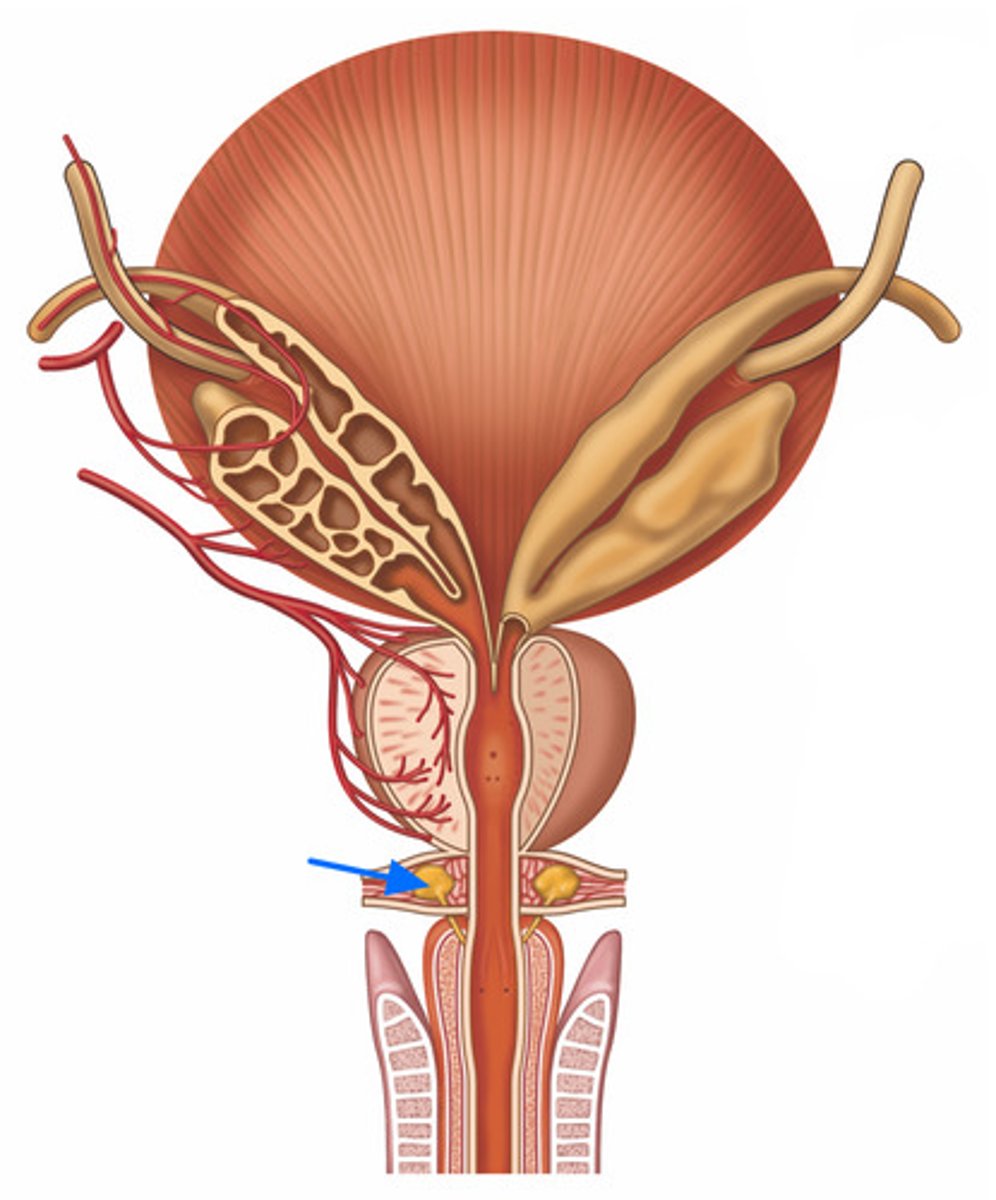 <p>ID Structure Marked with the Blue Arrow</p>