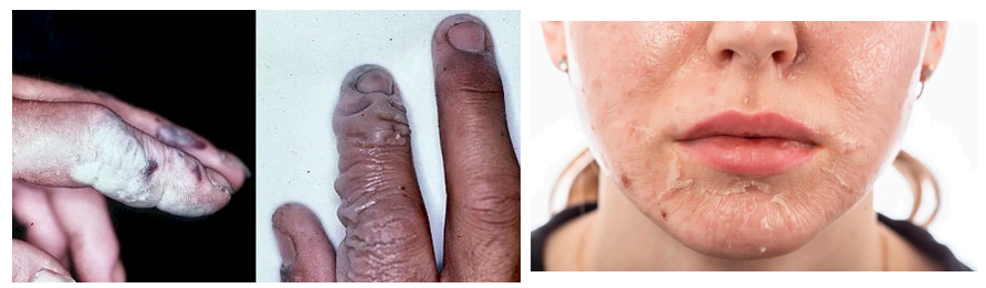 <p>Alkali products</p>