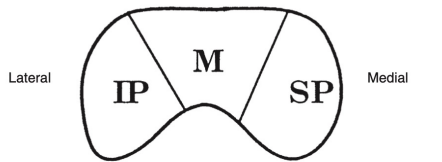 <p>As the fibers leave the chiasm in the optic tract, the <strong>crossed and uncrossed fibers intermingle</strong> </p><p>The<strong> superior fiber</strong>s (the fibers from both the<strong> ipsilateral superior temporal</strong> retina and the <strong>contralateral superior nasal</strong> retina) <strong>move </strong>to the<strong> medial side </strong>of the tract. </p><p>The fibers from the <strong>inferior retina</strong> (<strong>ipsilateral inferior temporal</strong> retinal fibers and <strong>contralateral inferior nasal </strong>retinal fibers) occupy the <strong>lateral area</strong> of the tract. </p><p>The <strong>macular fibers</strong> remain in the<strong> middle</strong> of the groups</p>