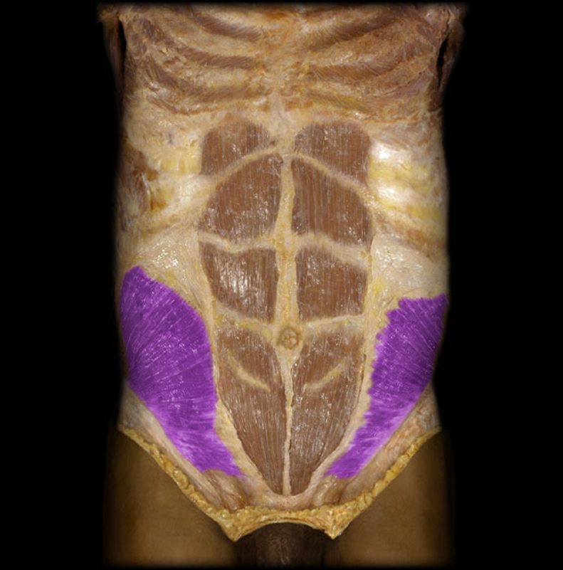 <p>Internal abdominal oblique</p>