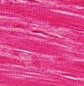 <p>Identify this muscle tissue, its location, and its function.</p>