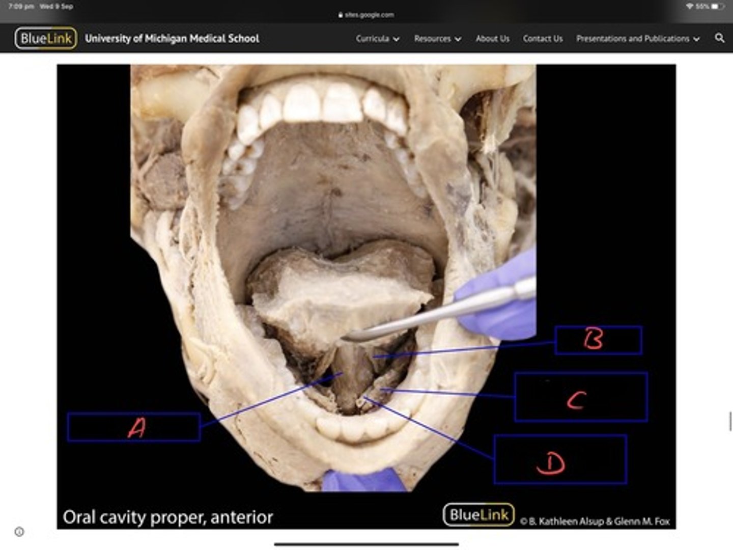 <p>Under tongue struecture</p>
