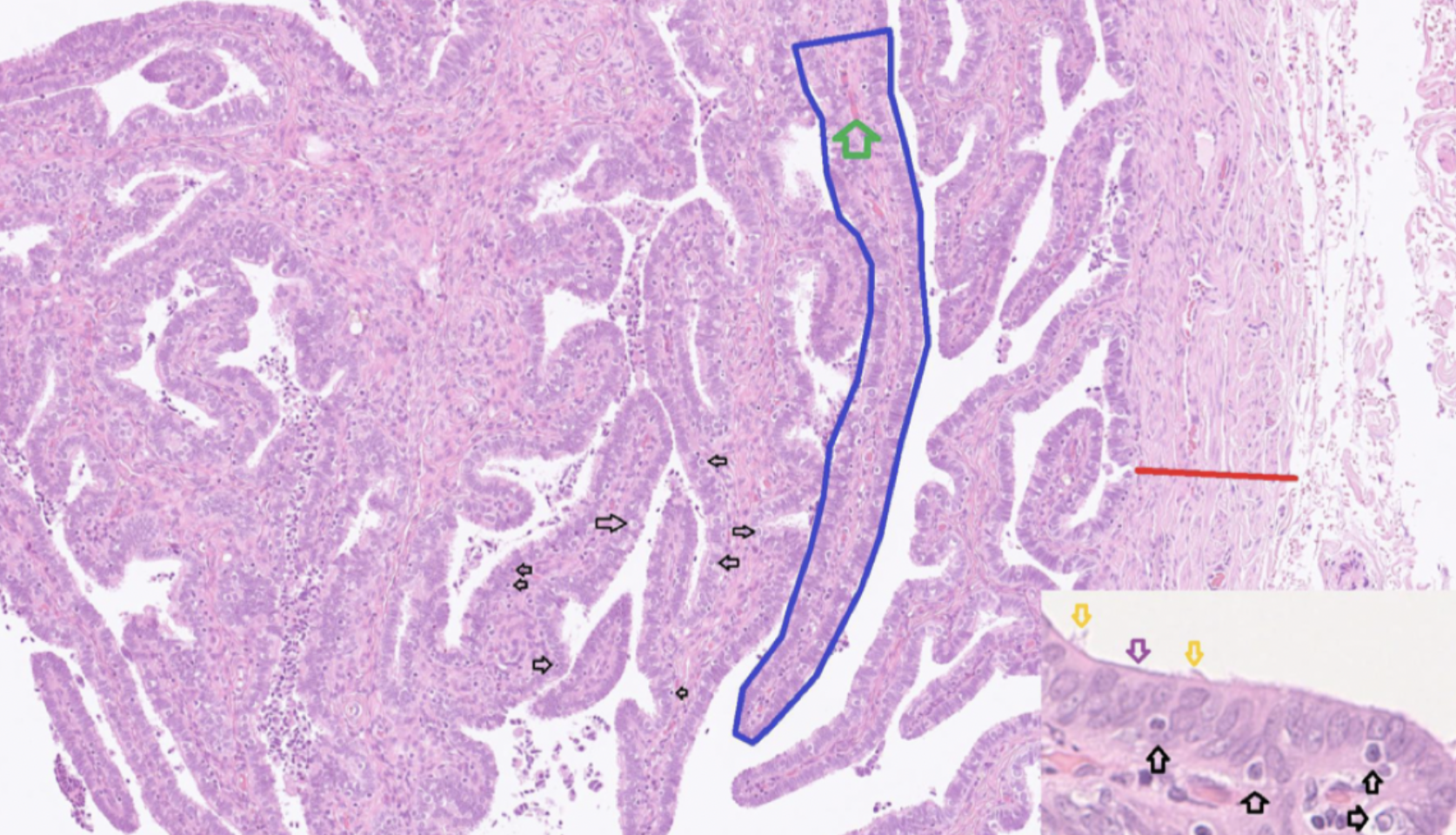 <ul><li><p>Mucosa</p><ul><li><p>Enkelskiktat cylindriskt epitel</p></li><li><p><strong>Cilierade</strong> <strong>celler</strong> mot lumen (orange)</p></li><li><p>Sekretoriska <strong>peg-celler</strong> mot lumen (lila)</p></li><li><p>Lymfocyter (svart)</p></li></ul></li><li><p>Tunica muscularis (röd)</p><ul><li><p>Inre cirkulärt</p></li><li><p>Yttre longitudinellt </p></li></ul></li></ul><p>Mucosan finns i <strong>plicae</strong> (blå). </p>