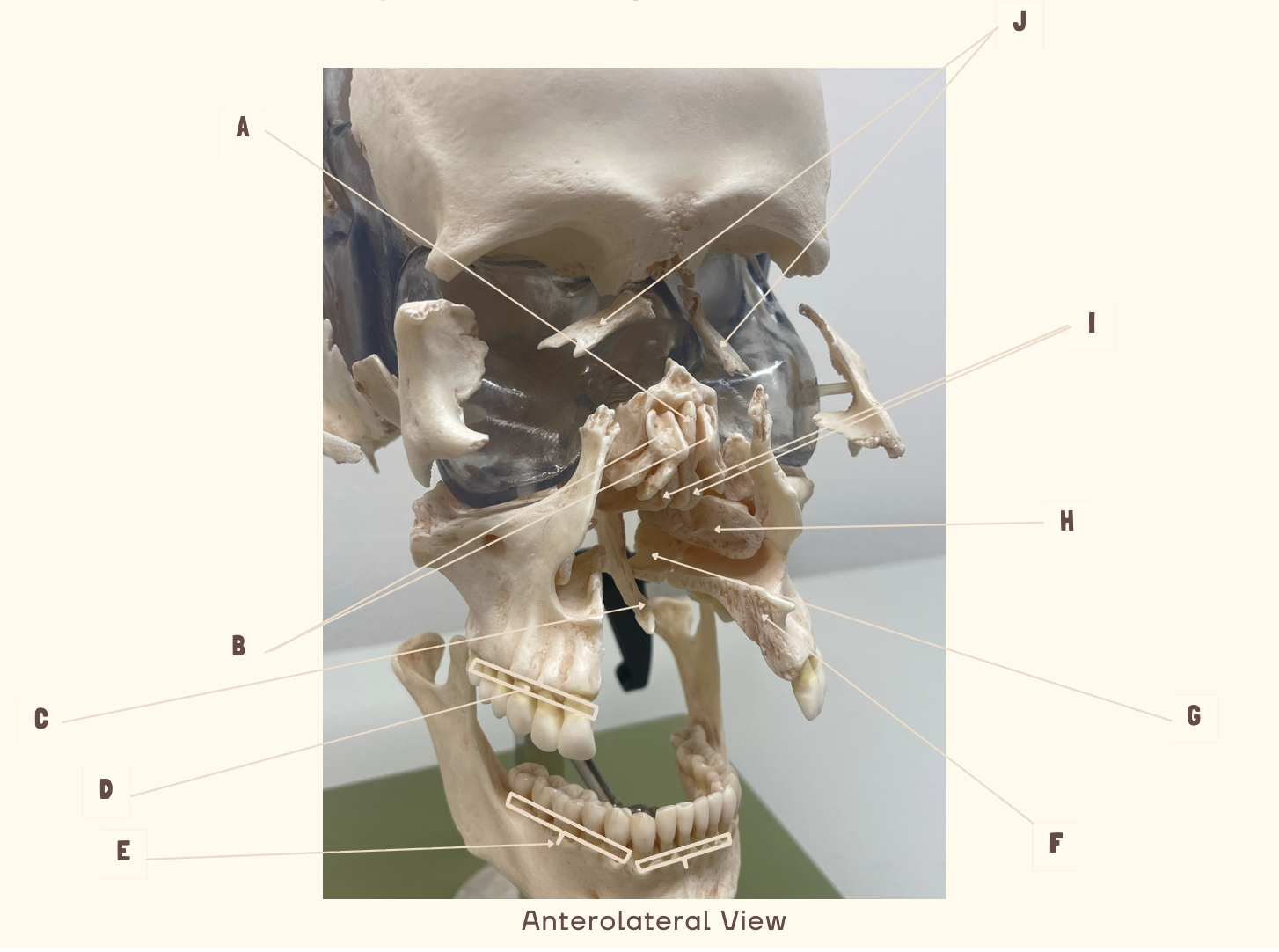 <p>This one as well!</p>