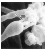 <p>Basidiomycota</p>