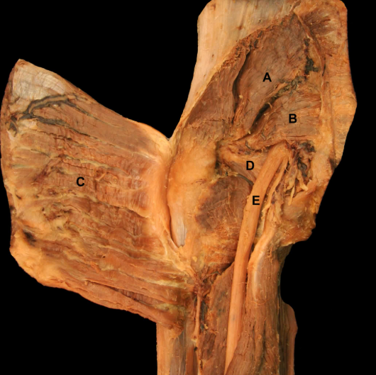 <p>C</p>