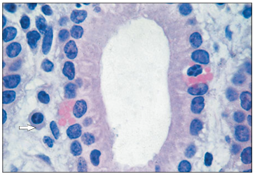 <p>Identify the structure:</p><p>Specie:</p><p>Stain used:</p>