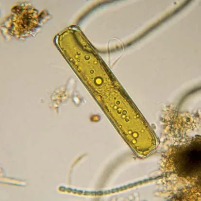 <p>What is this type of algae called?</p>