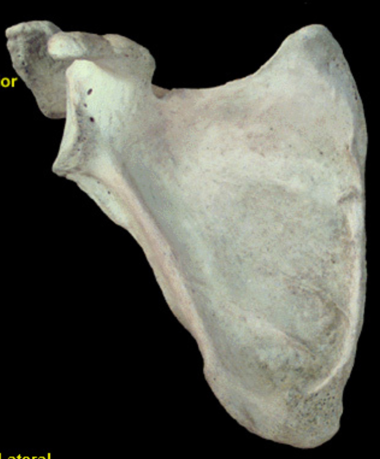 <p>What bone is this?</p>