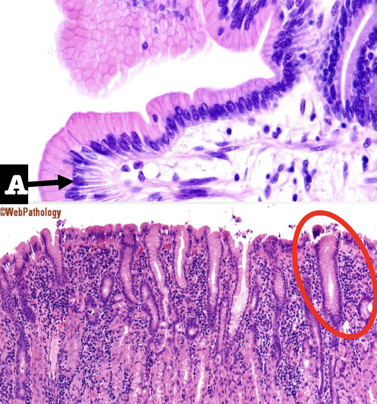 <p>A: Lining Epithelium</p><p>Encircled: Mucous Neck Cells</p>