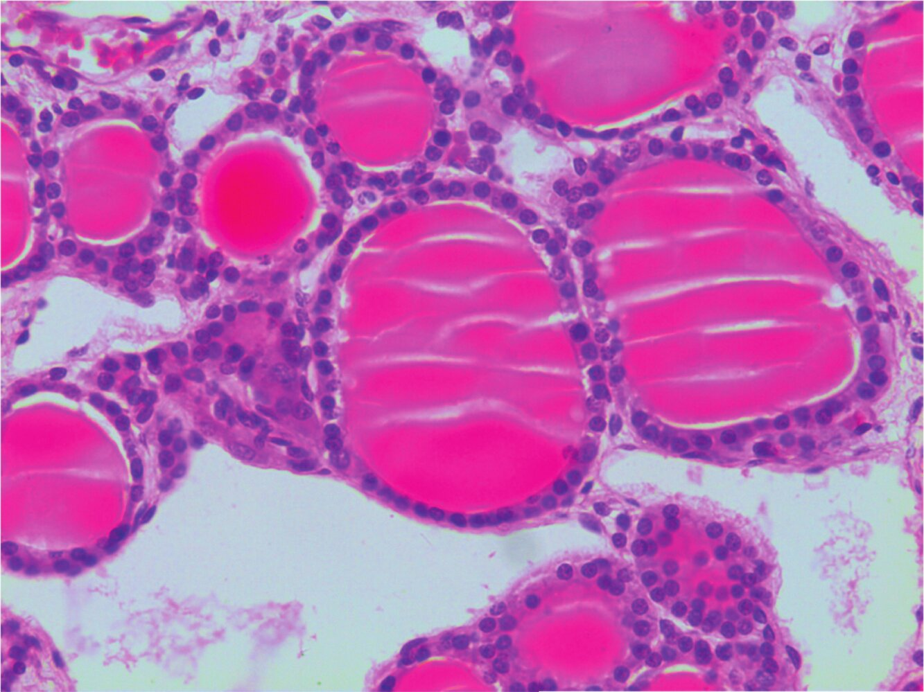 <p>10. Which statement about the function of the organ shown in the image is <strong>NOT</strong> true?</p><p>A. It produces a hormone that influences calcium metabolism in cases of hypercalcemia.</p><p>B. It produces a hormone that regulates body temperature.</p><p>C. It produces a hormone that affects anterior pituitary cells via a feedback loop.</p><p>D. It produces a steroid hormone.</p><p>E. It produces an iodine-containing hormone.</p>