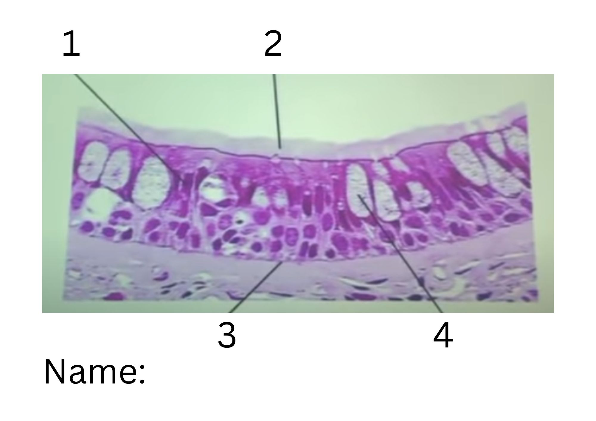 term image
