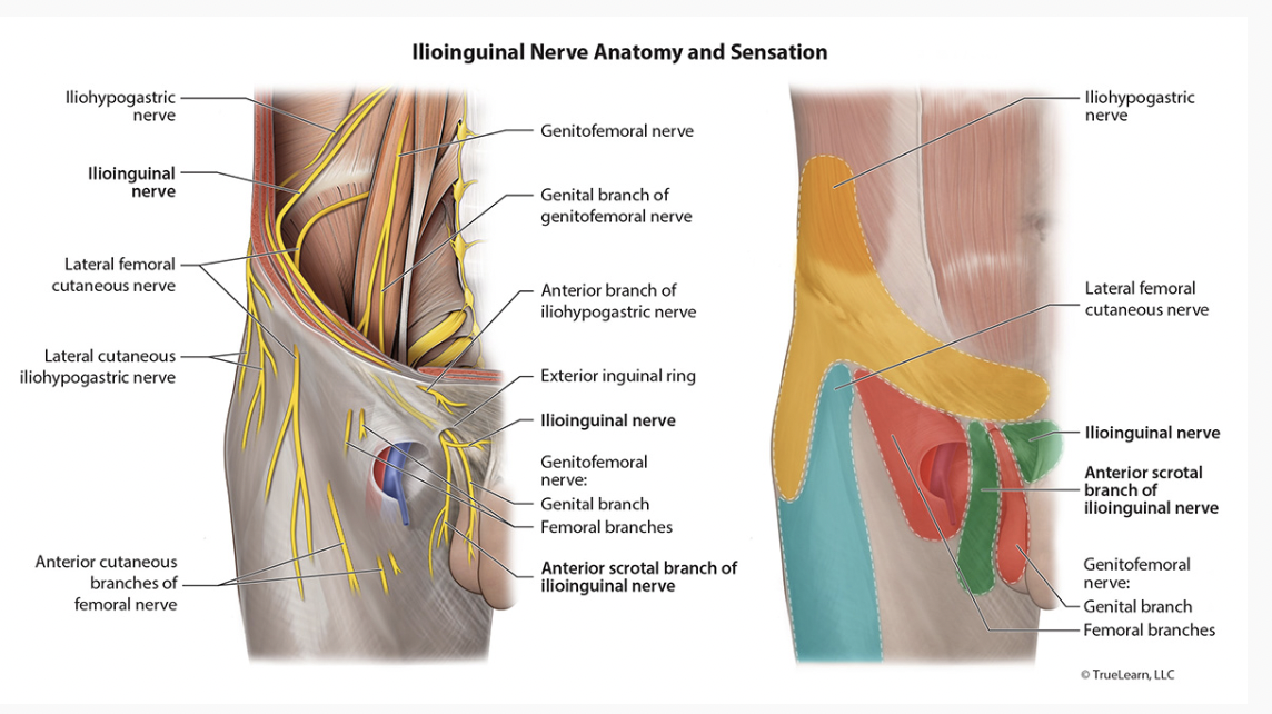 <p>Injury to Nerves during Inguinal Hernia Repair </p>