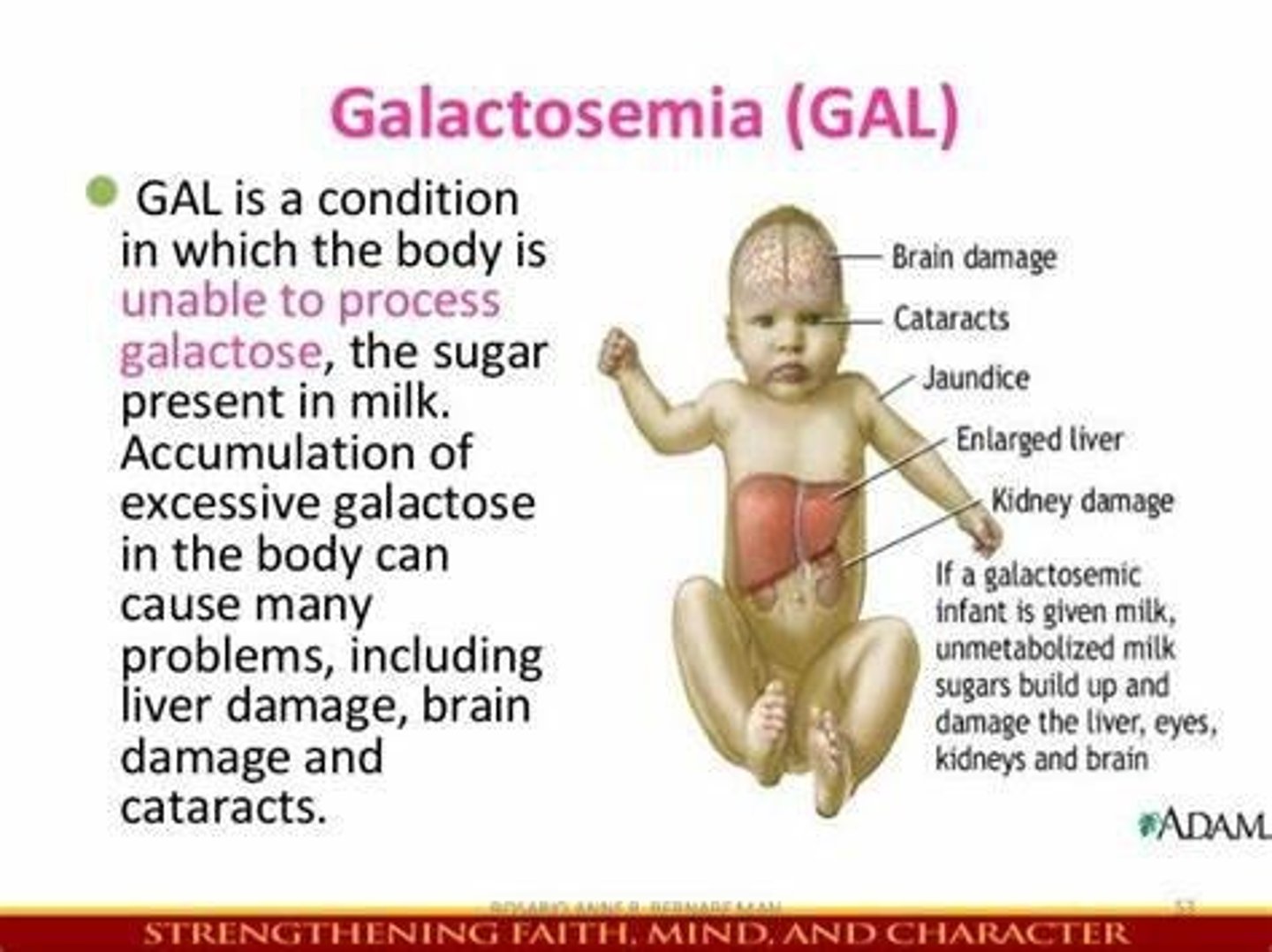 <p>Deficiency of galactose 1 phosphate uridyl transferase (GALT), leading to the inability to convert galactose to glucose.</p>