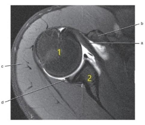 <p>What is letter d?</p>