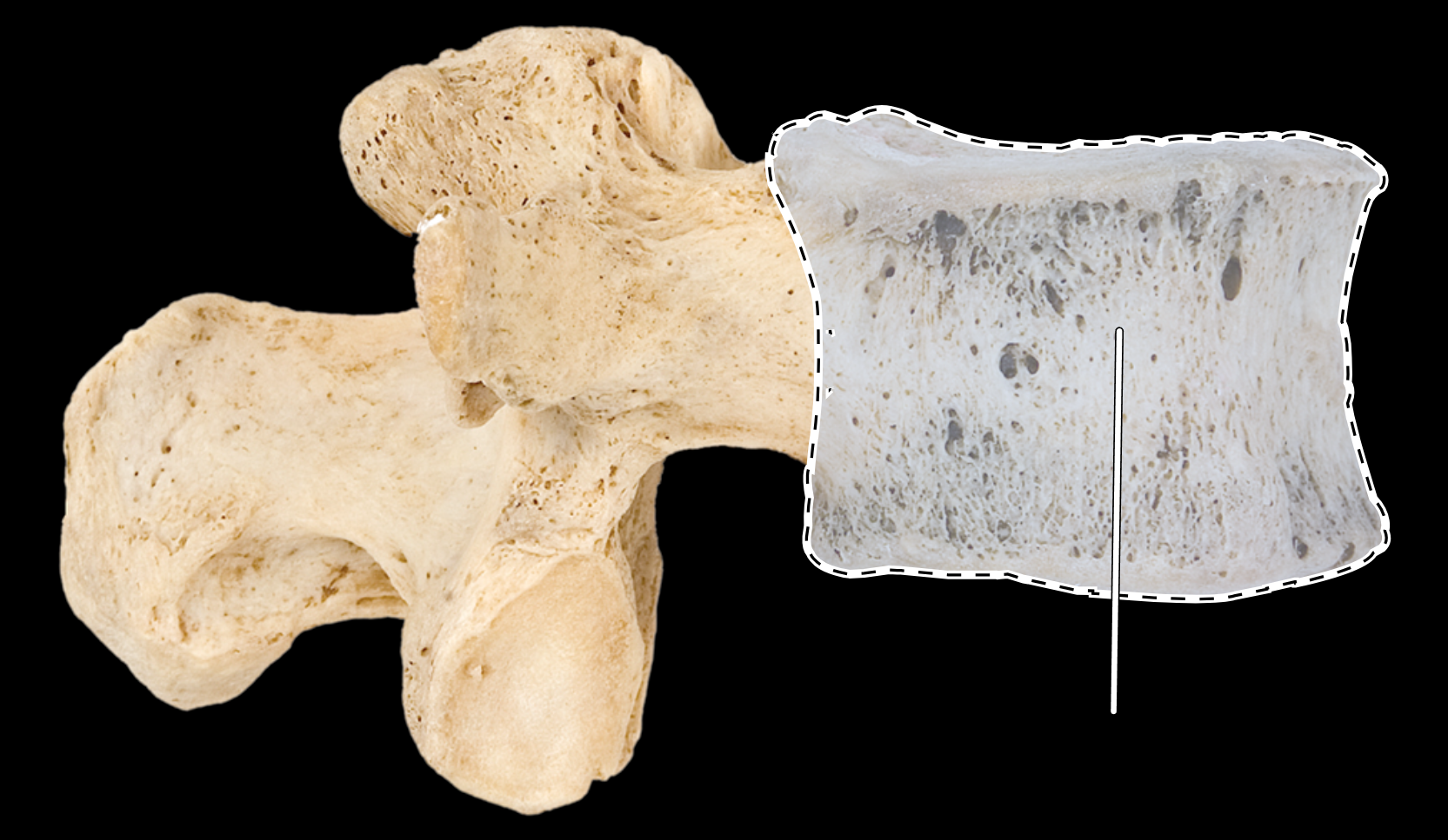 <p>Name the highlighted portion.</p><p>(Lumbar vertebra, lateral view).</p>