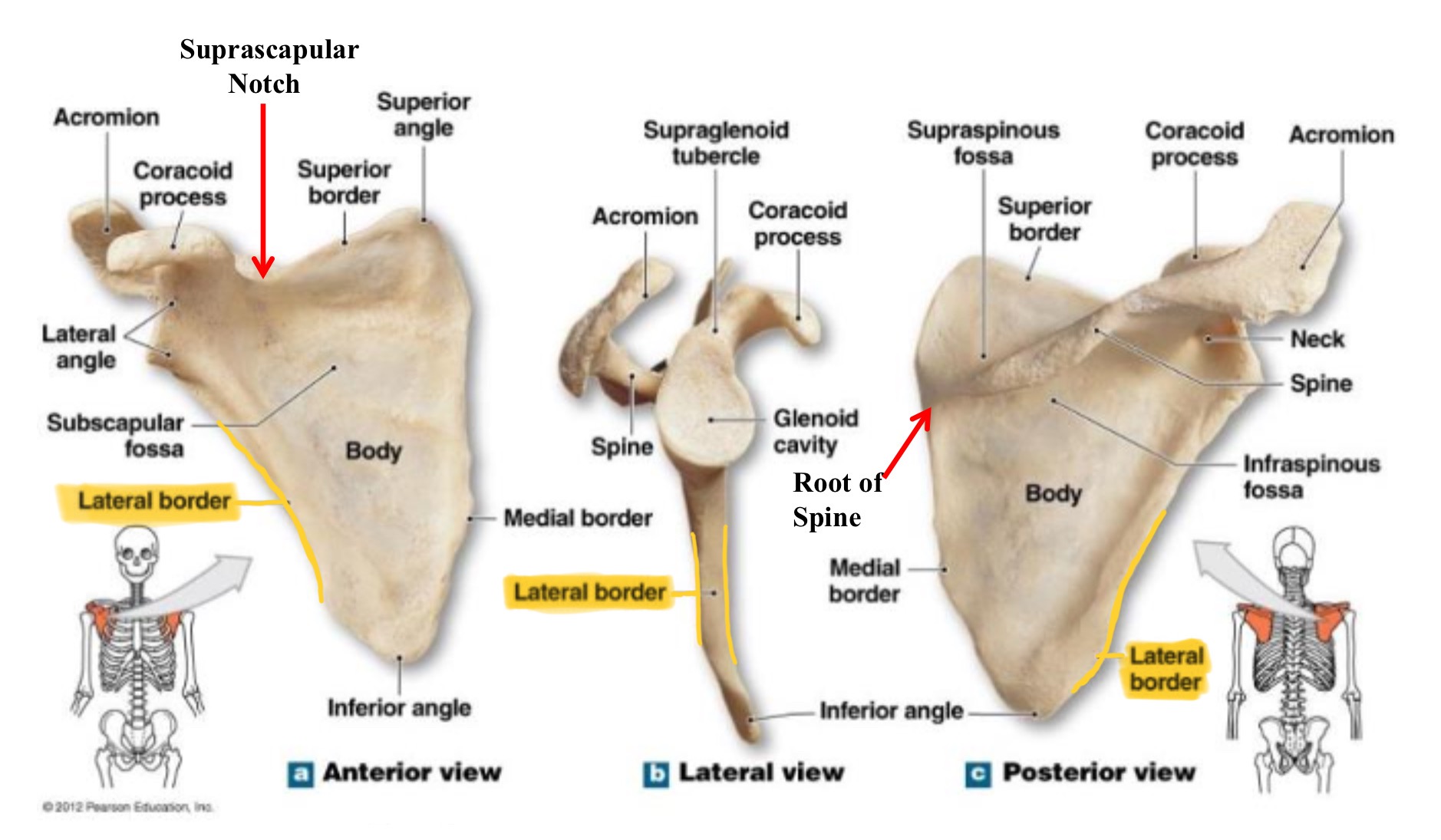 <p>lateral border of scapula (axillary border)</p>