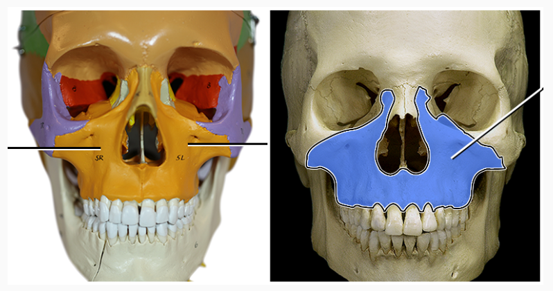 <p>The upper jaw and most of the hard palate. Both left and right.</p>