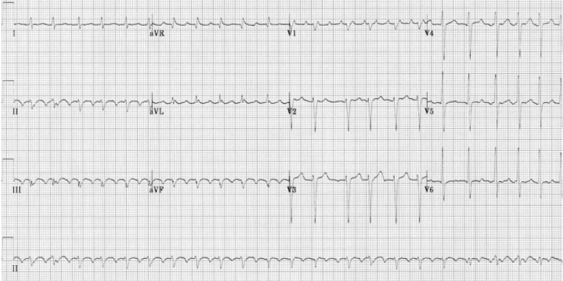 <p>What does this indicate</p>