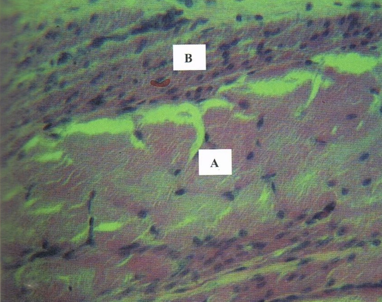 <p>Identify the structure&nbsp;</p>