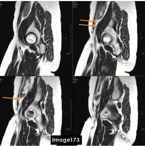 <p>The artifact indentified by the orange arrows in this image is a ___ artifact</p>
