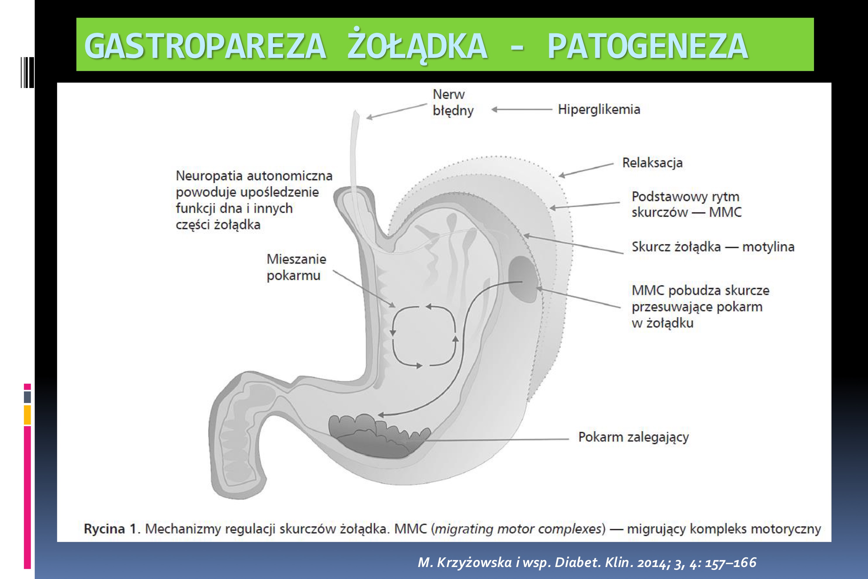 <p>Podstawowe patomechnizmy:</p><p><span data-name="black_small_square" data-type="emoji">▪</span> Zaburzenia w zewnętrznej kontroli neuronalnej</p><p>(nerwu błędny - EPAN),</p><p><span data-name="black_small_square" data-type="emoji">▪</span> Dysfunkcję wewnętrznych nerwów ENS (IPAN)</p><p><span data-name="black_small_square" data-type="emoji">▪</span> Zaburzenia komórek śródmiąższowych Cajala</p><p>zaangażowanych w kontrolę miejscową czynności</p><p>mięśni przewodu pokarmowego,</p><p><span data-name="black_small_square" data-type="emoji">▪</span> Utrata funkcja mięśni gładkich</p><p>Prowadzą do zmniejszenia lub braku motoryki</p><p>propulsywnej żołądka</p>