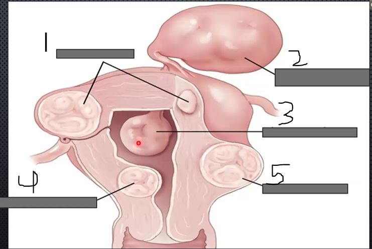 <p>what is 4?</p>