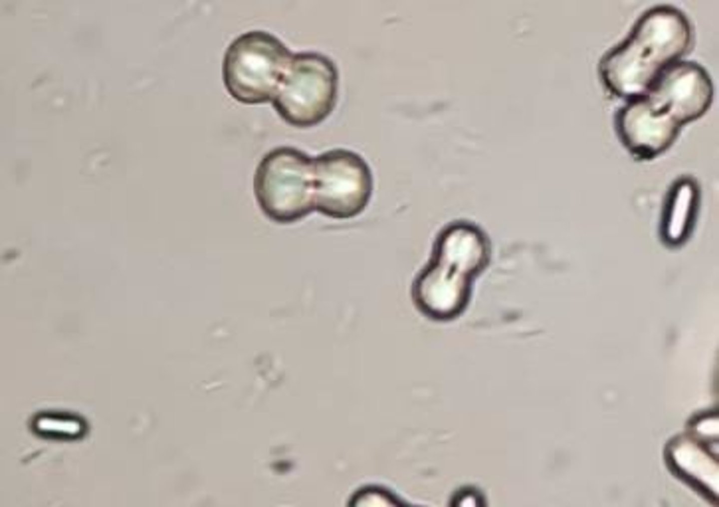 <p>alkaline urine, dumbbell shape, small, colorless</p>