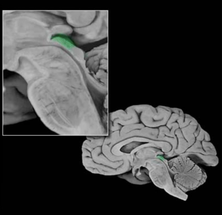 <p>Superior colliculus</p>