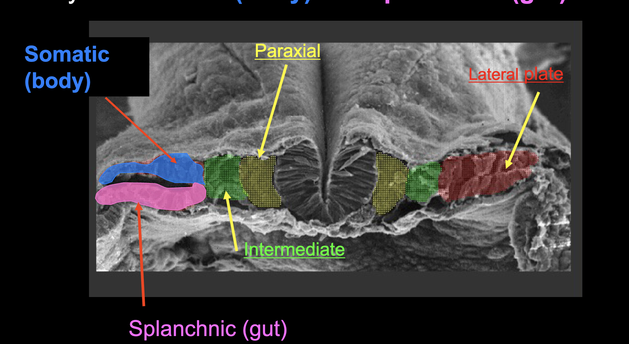 <p>Somatic (top) &amp; Splanchnic (bottom)</p>