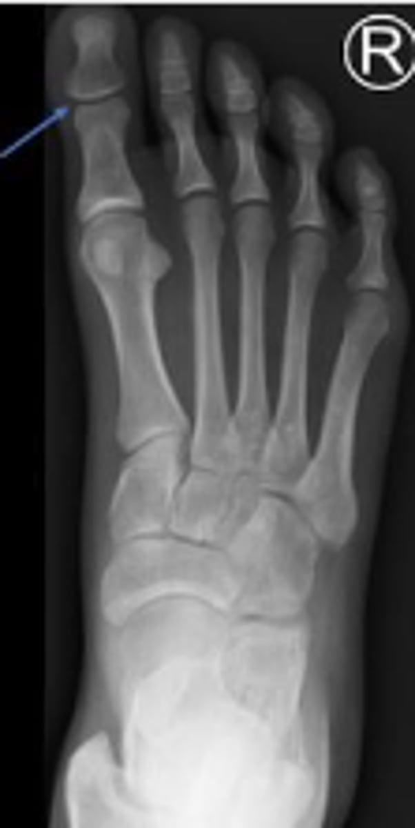 <p>What joint is the arrow pointing to?</p>