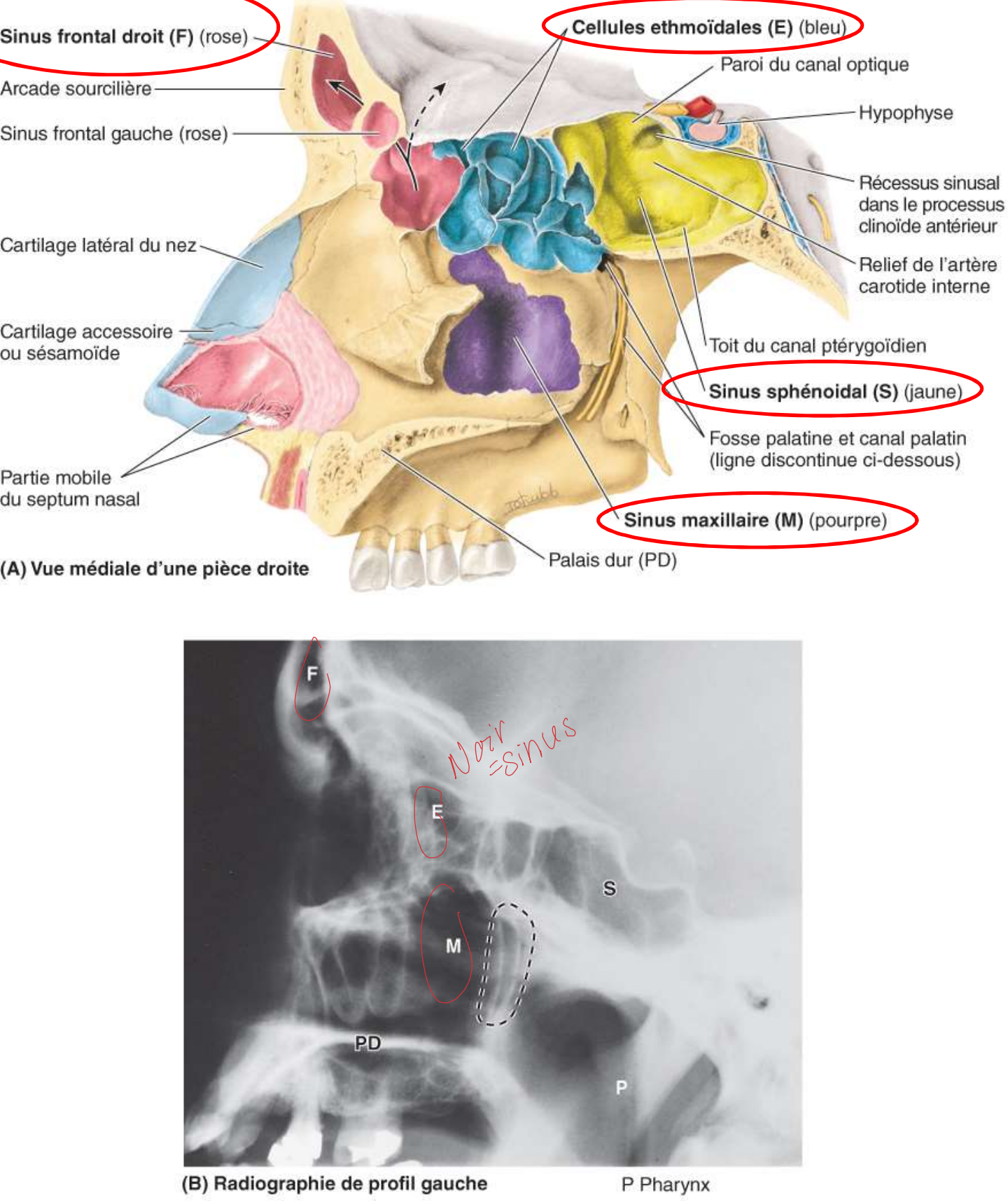 <p>Sinus frontal </p><p>Sinus ethmoïde</p><p>Sinus sphénoïde</p><p>Sinus maxillaire </p>