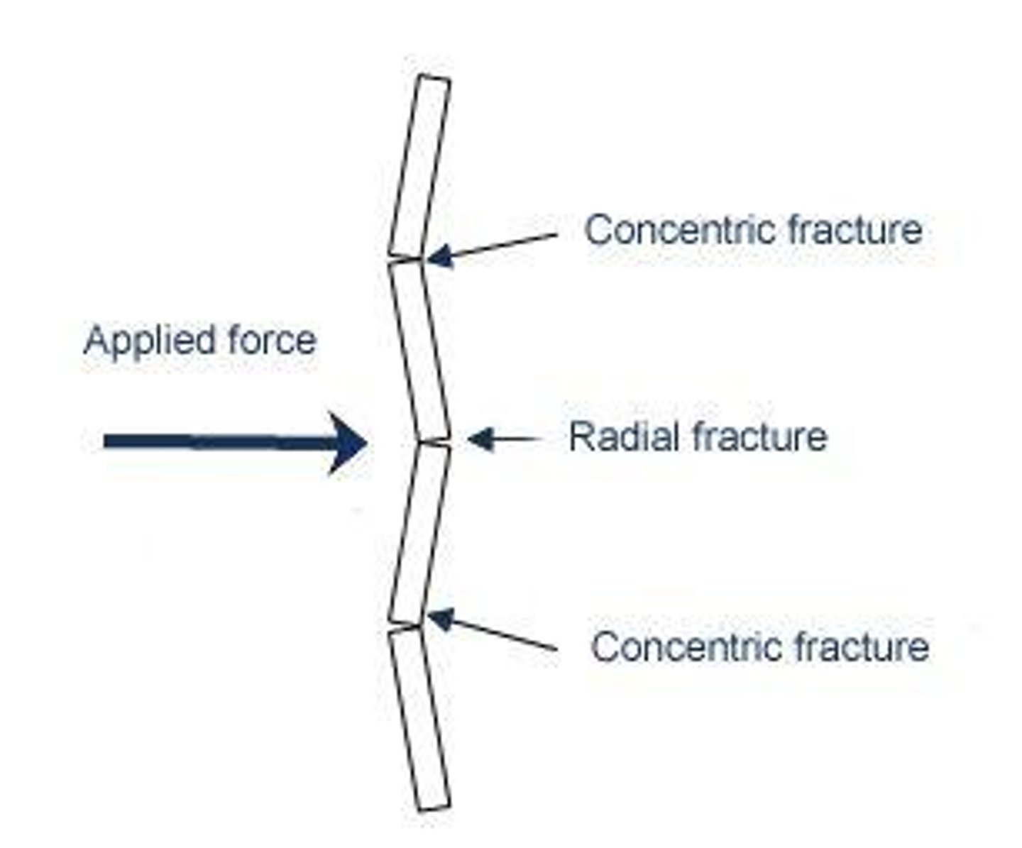 <p>Radial fractures spread out from the impact point, while concentric fractures form circles around the impact point.</p>